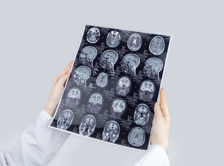 person holding brain scans