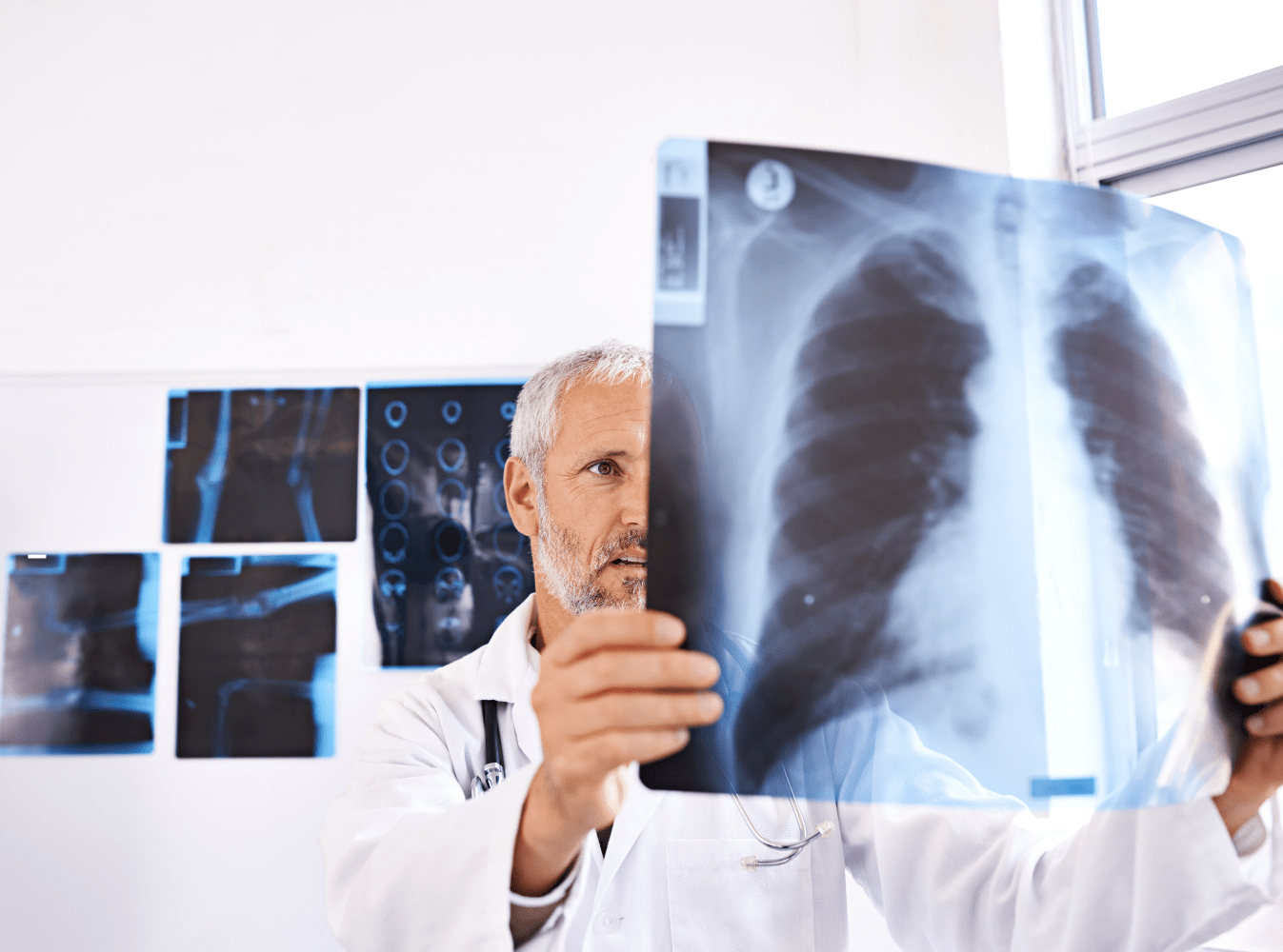 doctor viewing a chest xray