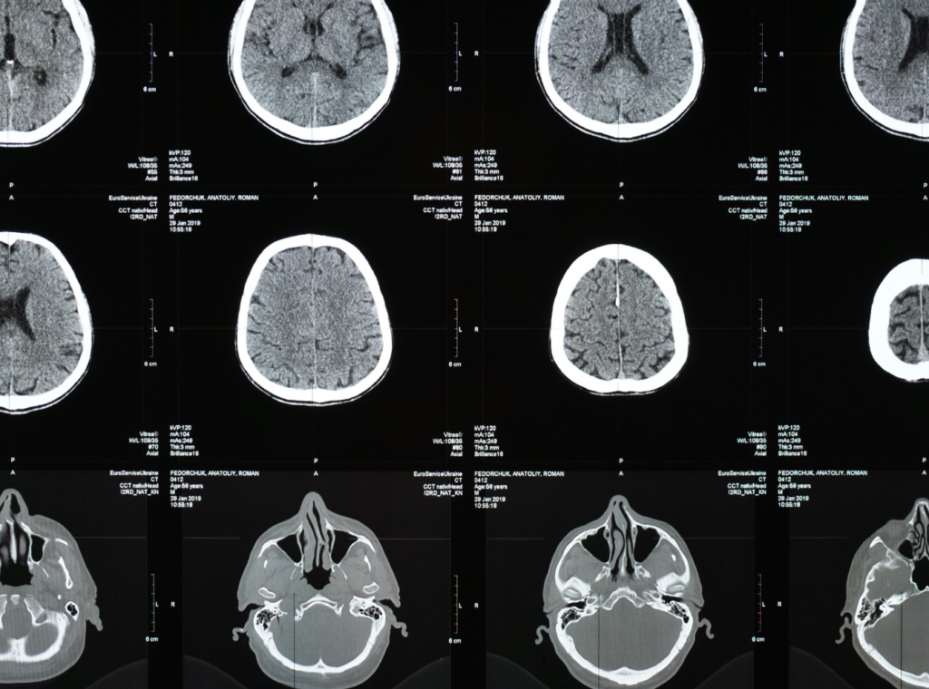 Neuropsychological Testing - Maginnis Howard