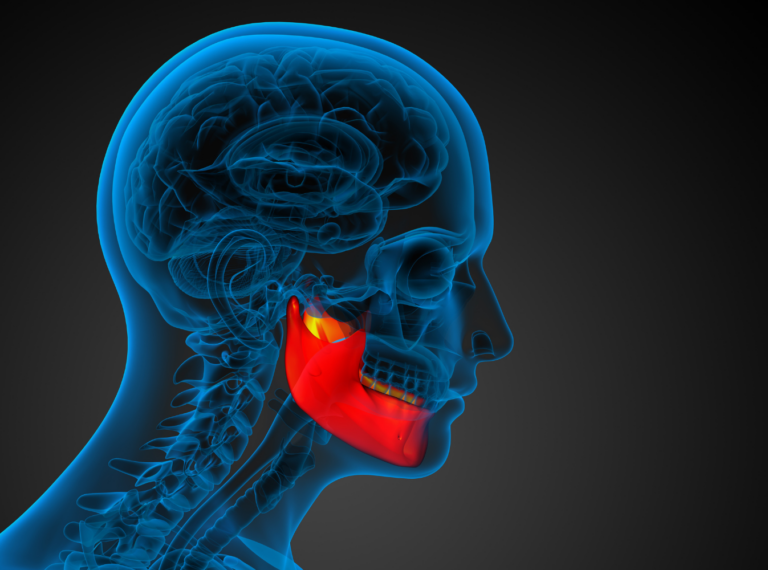 xray of a person's head with the jaw highlighted red